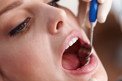 Oral checkup
